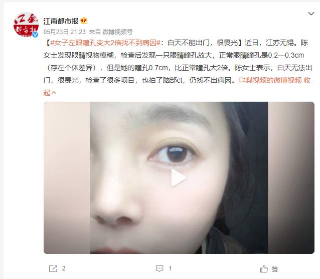 女子左眼瞳孔变大2倍找不到病因：白天不能出门